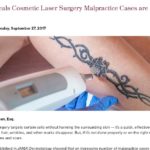 Cosmetic Laser Surgery article